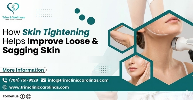 How Skin Tightening Helps Improve Loose and Sagging Skin